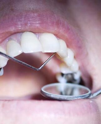The Tooth Place-How To Identify a Good Dentist?